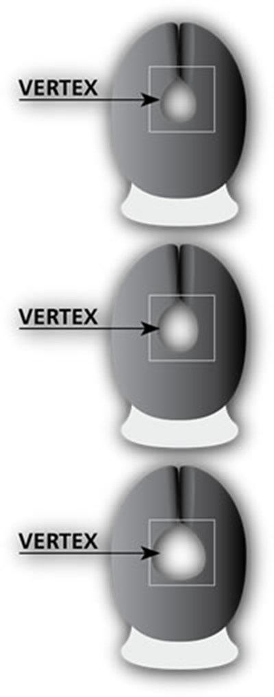 Image Description (Men Head (002))